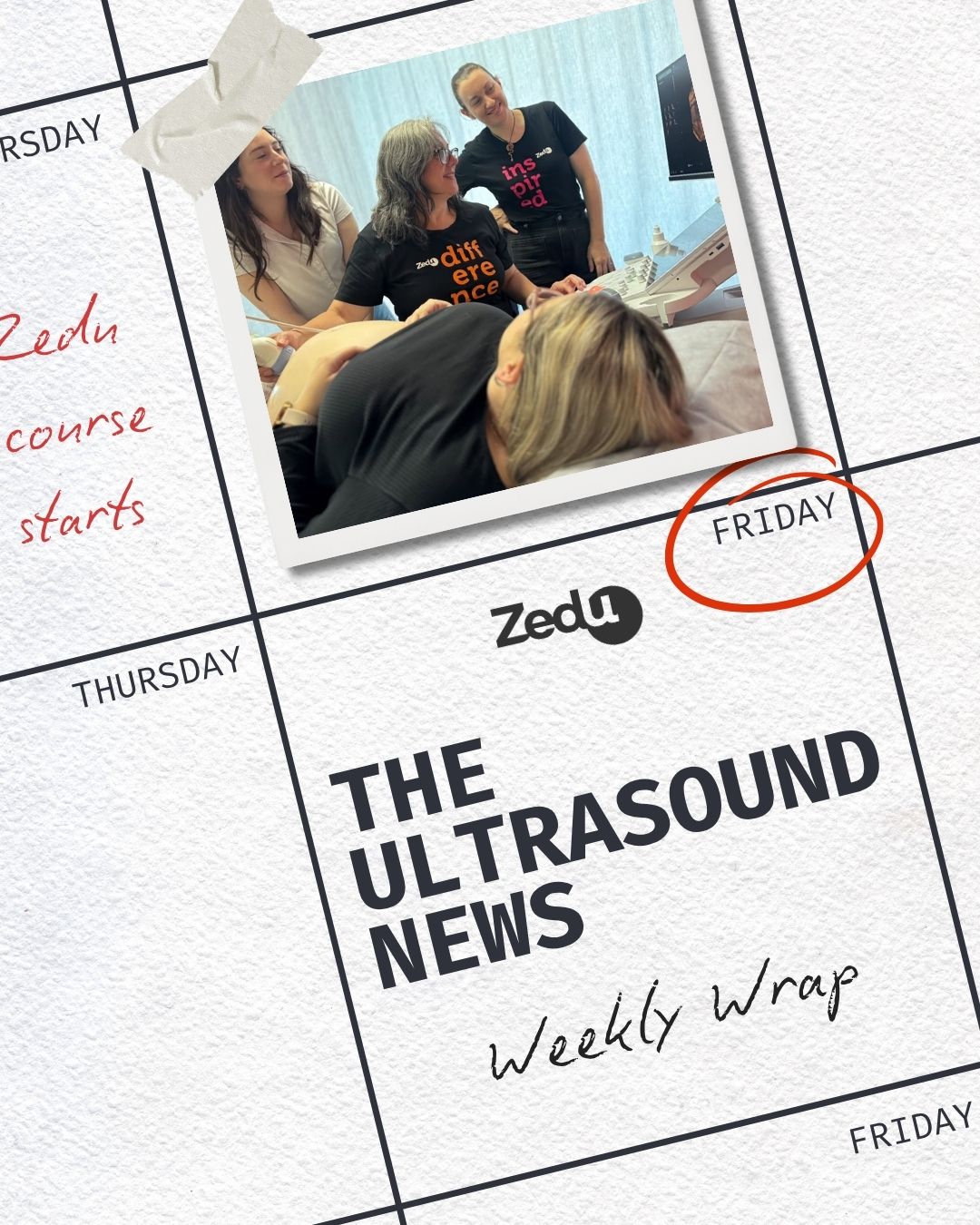 The Zedu weekly wrap - bringing together the best in free ultrasound news, views and opinions from across the internet.