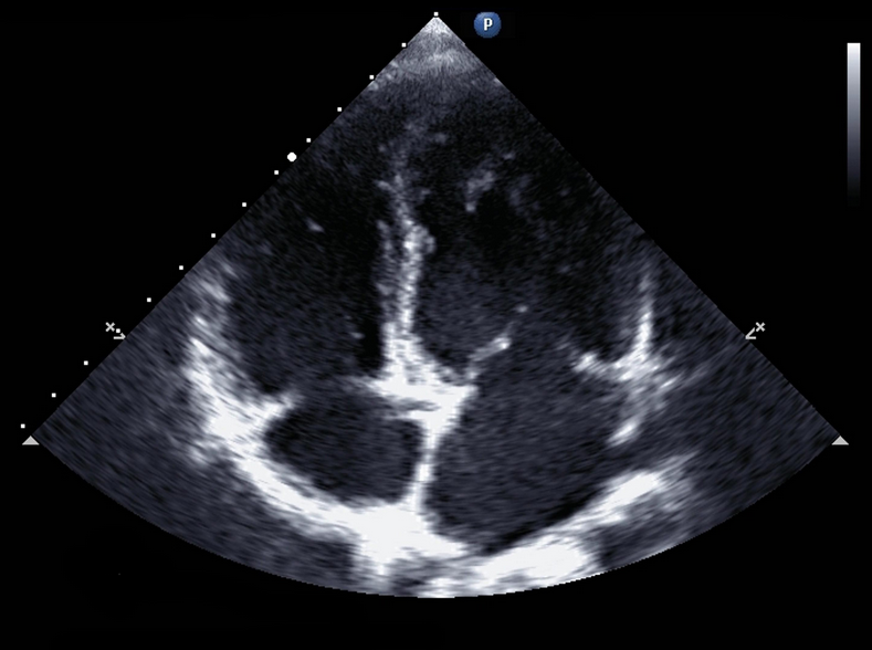 Why is learning ultrasound so important for critical care physicians Why is learning ultrasound so important for critical care physicians