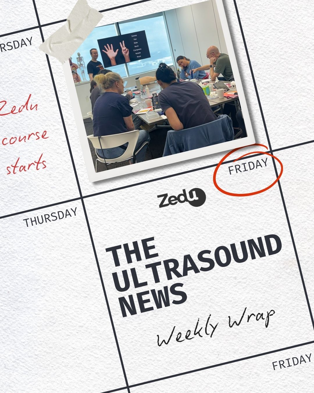 The Zedu weekly wrap - bringing together the best in free ultrasound news, views and opinions from across the internet.