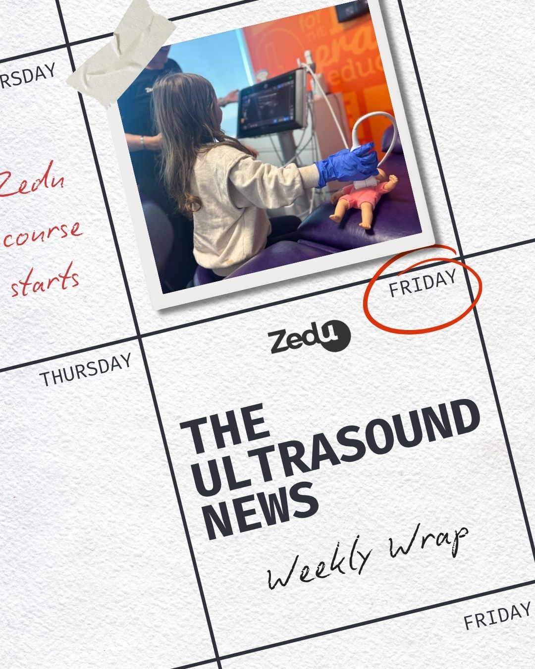 The Zedu weekly wrap - bringing together the best in free ultrasound news, views and opinions from across the internet.