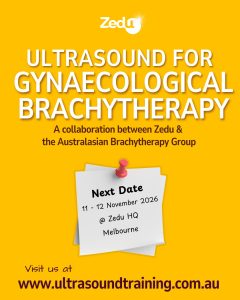 Zedu - ultrasound for gynaecological brachytherapy