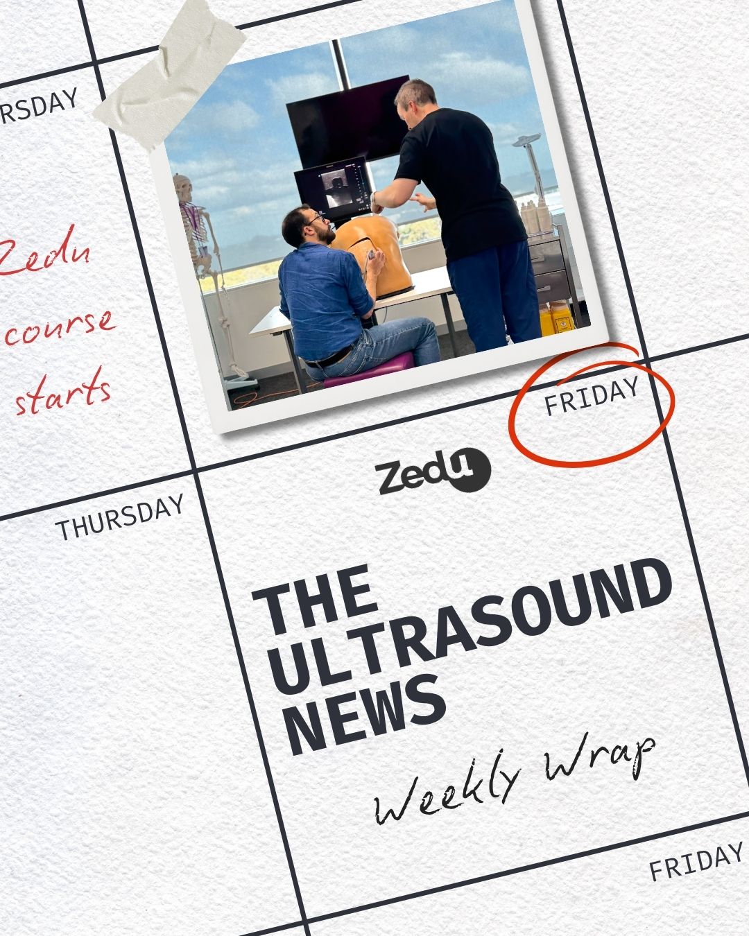 The Zedu weekly wrap - bringing together the best in free ultrasound news, views and opinions from across the internet.