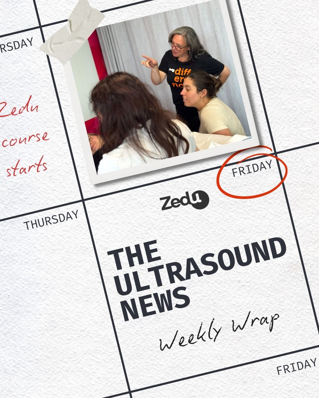 The Zedu weekly wrap - bringing together the best in free ultrasound news, views and opinions from across the internet.