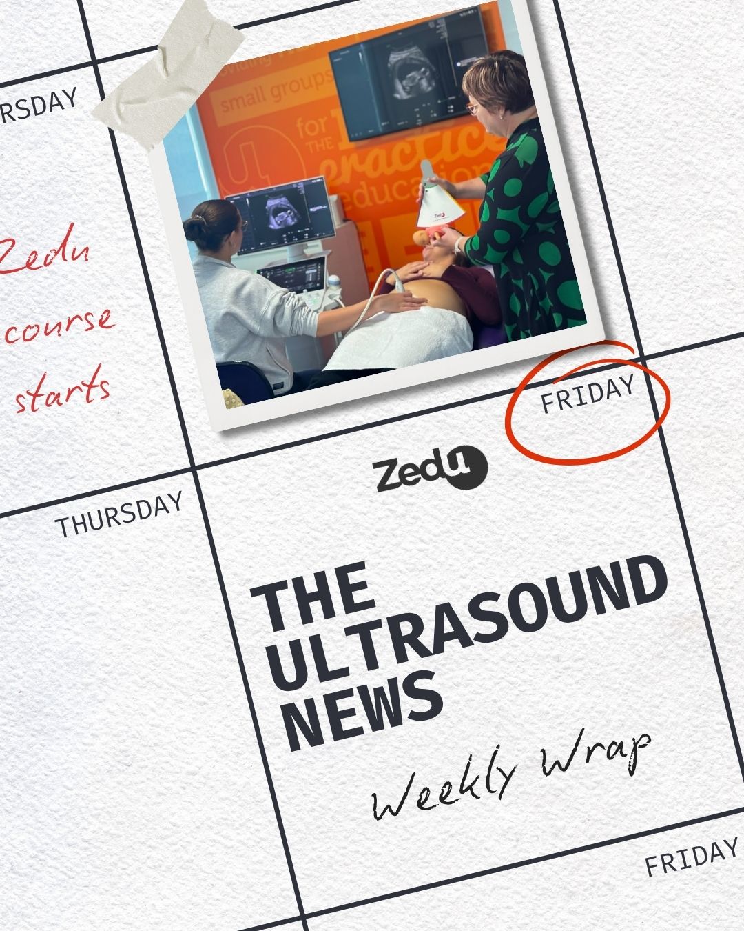The Zedu weekly wrap - bringing together the best in free ultrasound news, views and opinions from across the internet.